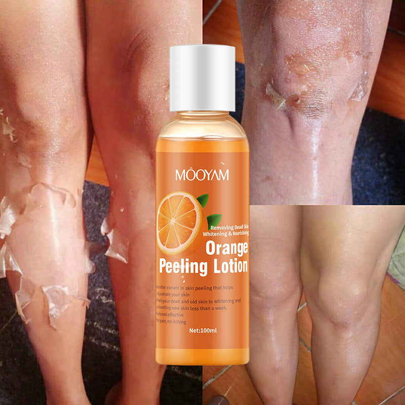 Beutra Orange Peel Exfoliating Lotion