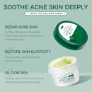 Anti-Acne Face Cream – Clearer Skin, Lasting Hydration